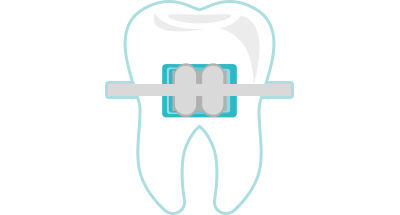 dentista chivasso, endodonzia, dentista chivasso, studio odontoiatrico zucano