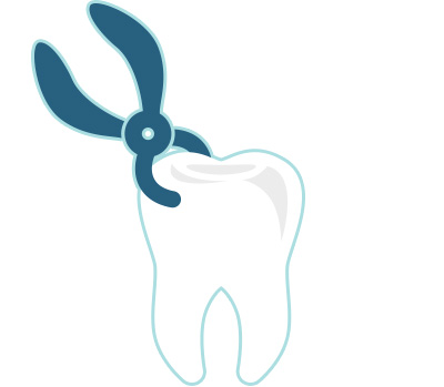 Implantologia e ortodonzia, dentista chivasso, dr zucano